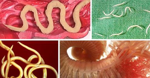 Types de parasites