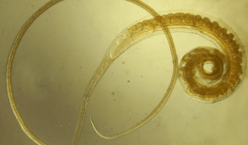 Trichocéphalose de vlasov