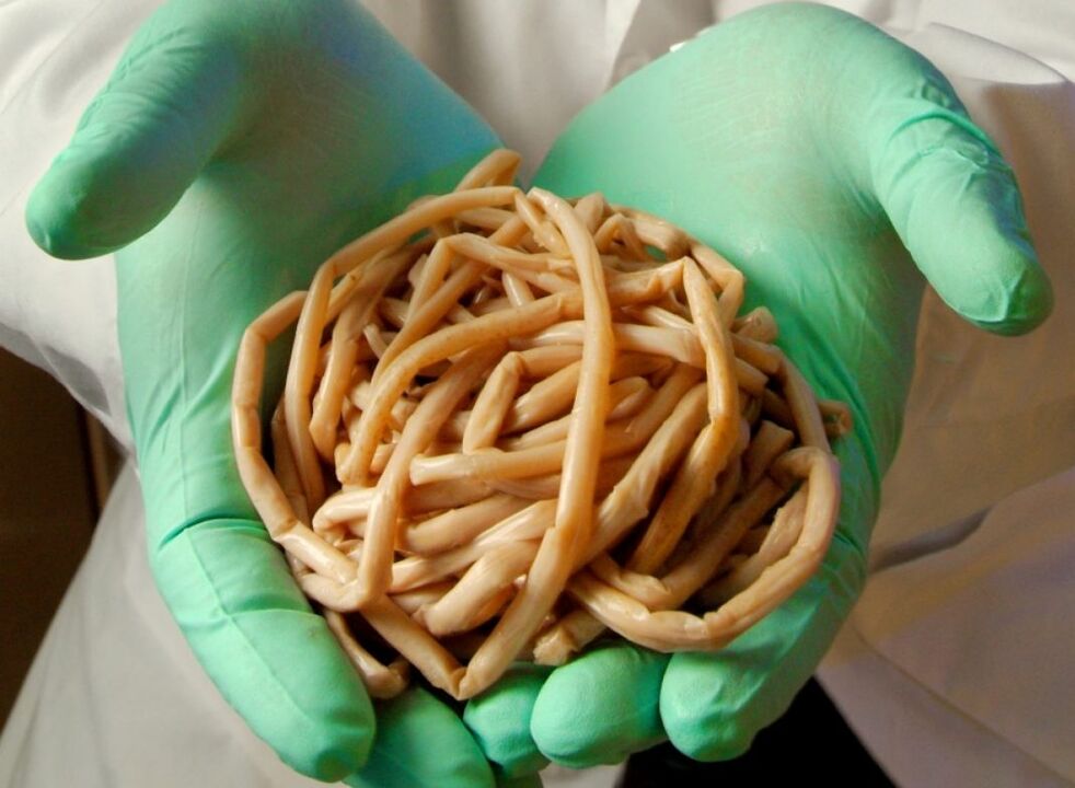 Quels parasites les humains ont-ils