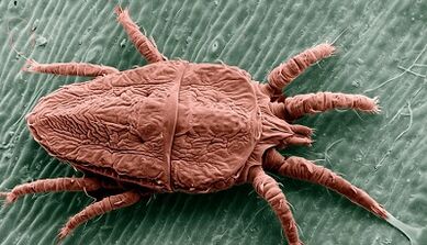 Méthodes de traitement des parasites dans le corps