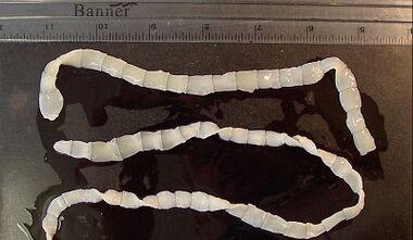 Types de parasites dans le corps humain